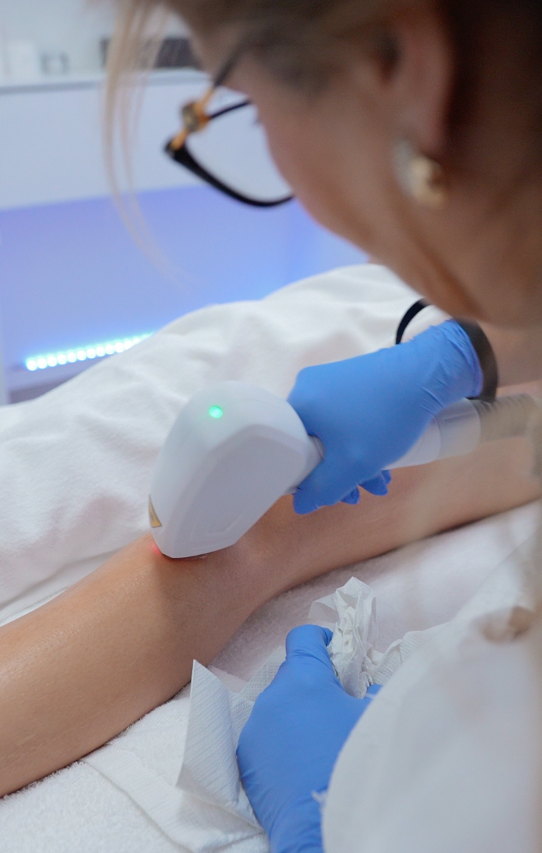 Dauerhafte Laser-Haarentfernung im Behandlungsraum von MIS Beauty
